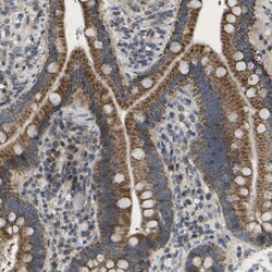 HADHA Antibody, Novus Biologicals 0.1mL; Unlabeled:Antibodies, Polyclonal